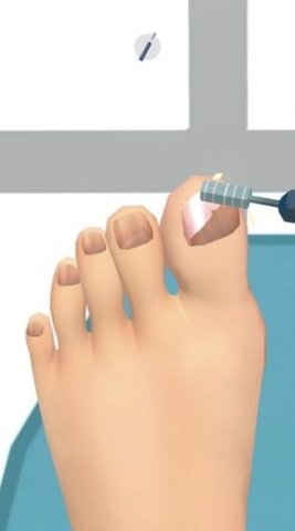 老板修个脚甲沟炎官方完整版